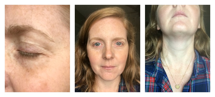 Does bakuchiol really work? We tried it. | After photos | ©️Kate Etue for Cool Mom Picks 