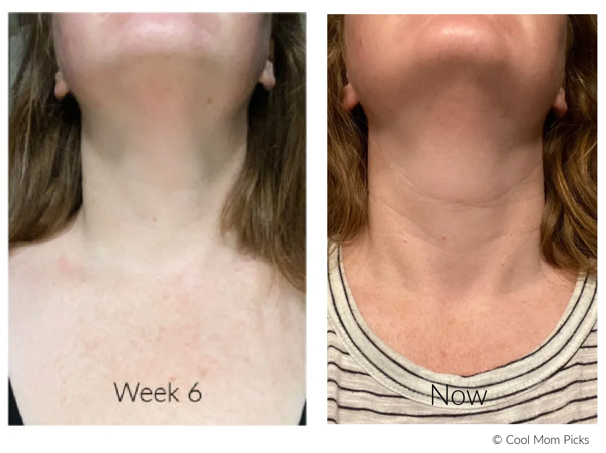 Trying DefenAge 6 Week Neck Perfecting Cream: Before and after photos. Whoa